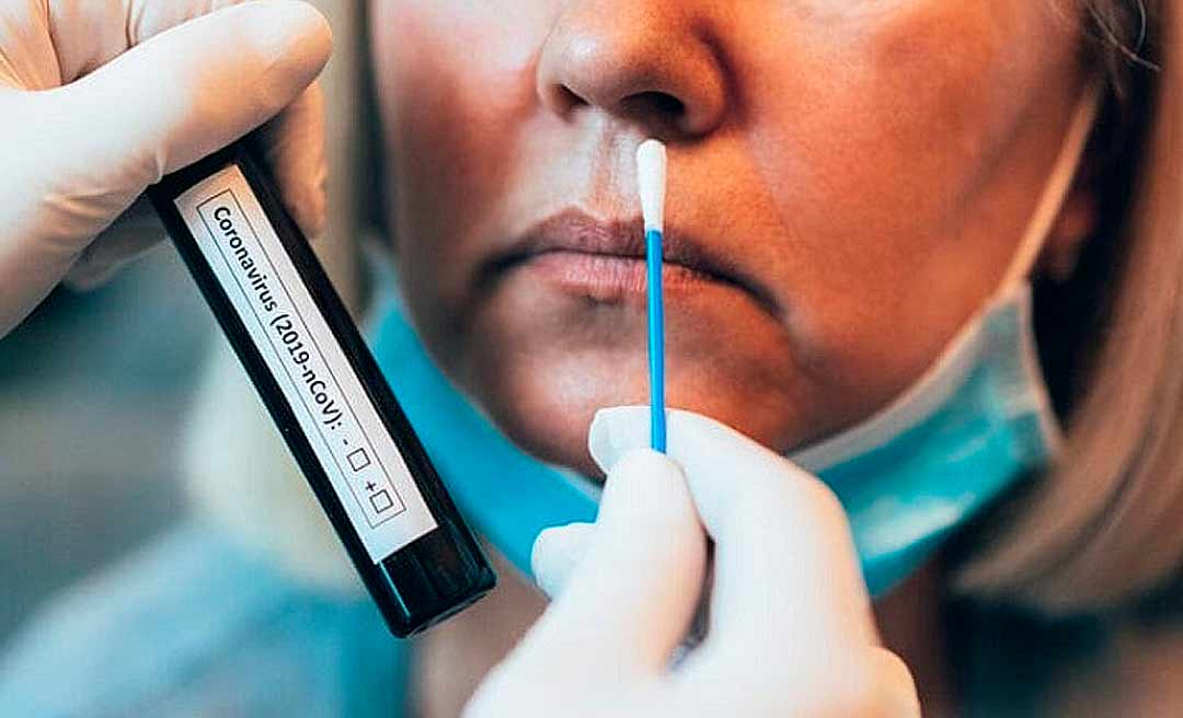 Acre confirma 2 novos casos de infecção por coronavírus, mas não registra óbitos nesta segunda